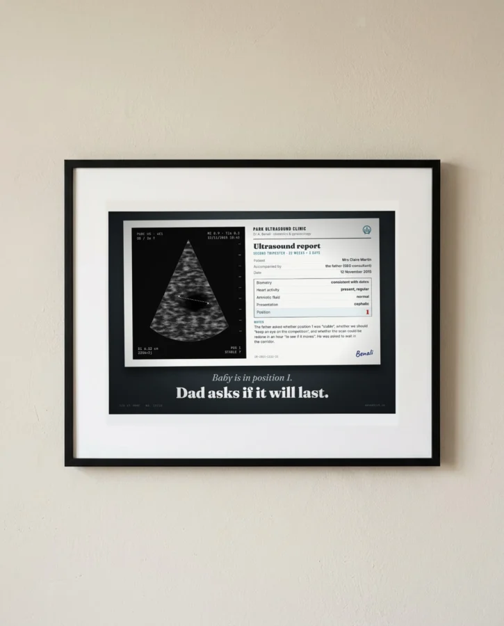 Ultrasound: baby in position 1 – Posters