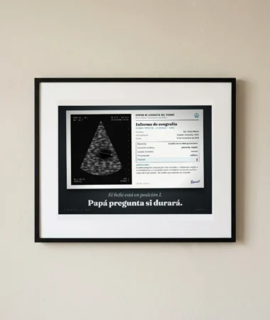 Ecografía: bebé en posición 1 – Pósters
