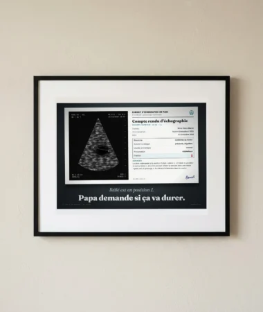 Échographie : bébé en position 1 – Posters