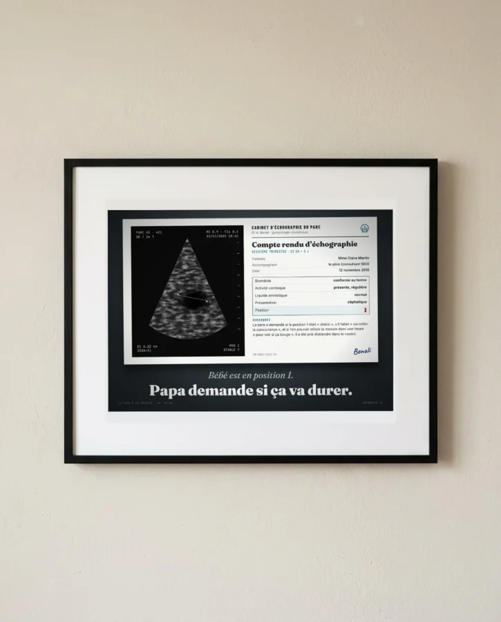 Échographie : bébé en position 1 – Posters